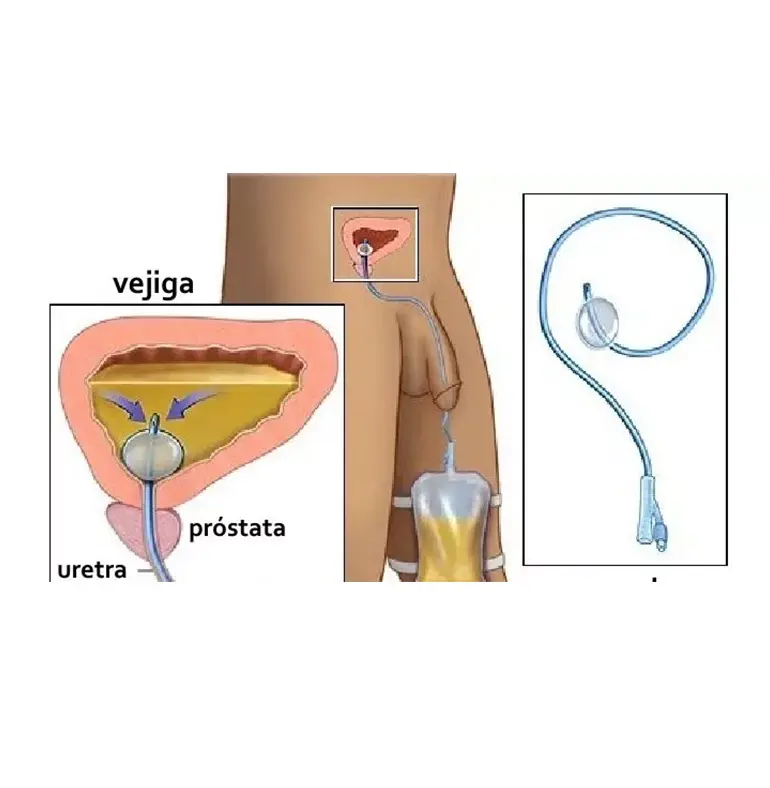 Dr. Edgar Beltrán Suárez - Especialista en cirugía HOLEP en CDMX