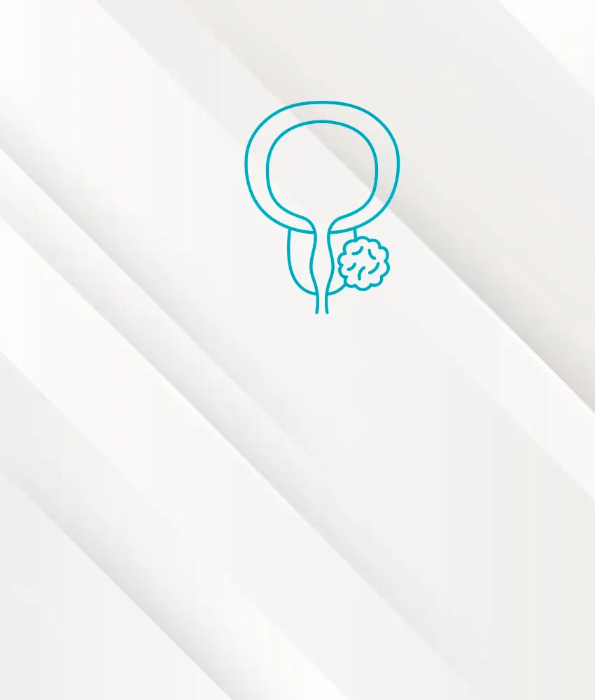 cáncer de próstata urológo dr edgar beltrán suárez